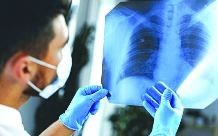 World Lung Cancer Day pualin- chuap cancer lan chhuah hmasak dan leh hriattur pawimawh